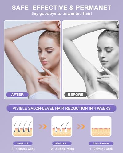 IPL Hair Removal Device with Cooling D63470